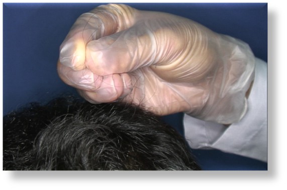 Günlük kaç tel saç dökülmesi normaldir?